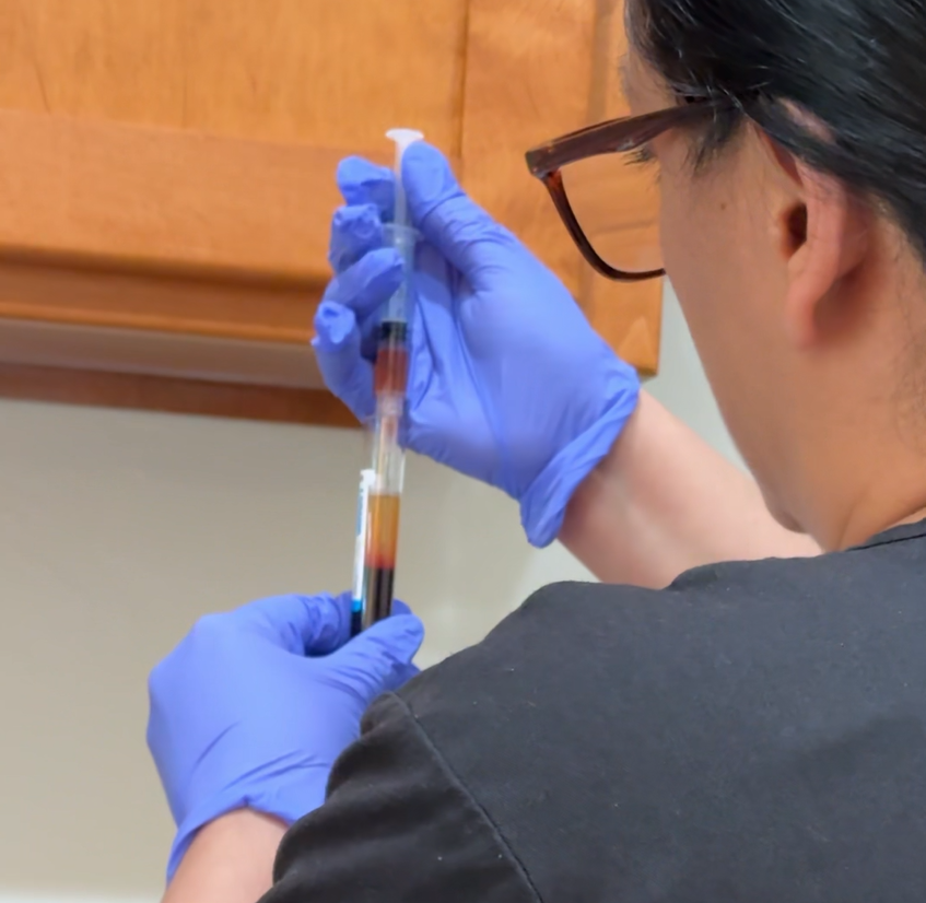 Platelet-rich fibrin preparation for regenerative aesthetic treatment at Anagen Medical Institute in Edmond, OK