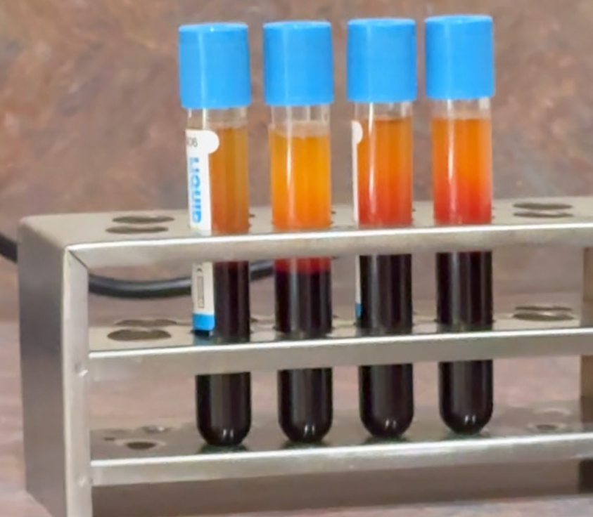 Platelet-Rich Fibrin (PRF) vials prepared for regenerative medicine treatment